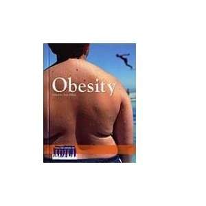  Obesity (9780737721942) Eric Dillon Books