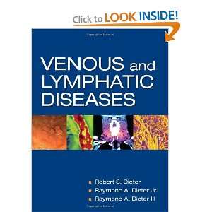  Venous and Lymphatic Diseases [Hardcover] Robert Dieter 
