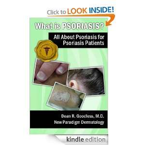 What is Psoriasis? All About Psoriasis for Psoriasis Patients (Dr 